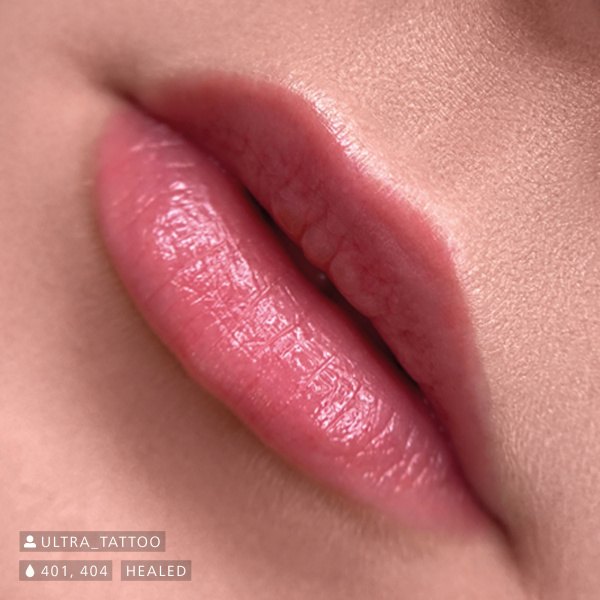 Close up of healed lip pigmentation